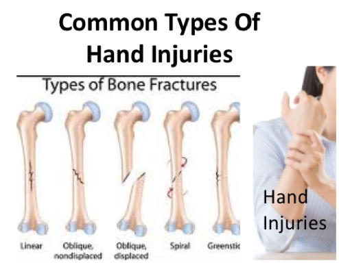 Common hand injuries that require seeking attention from hand surgeon